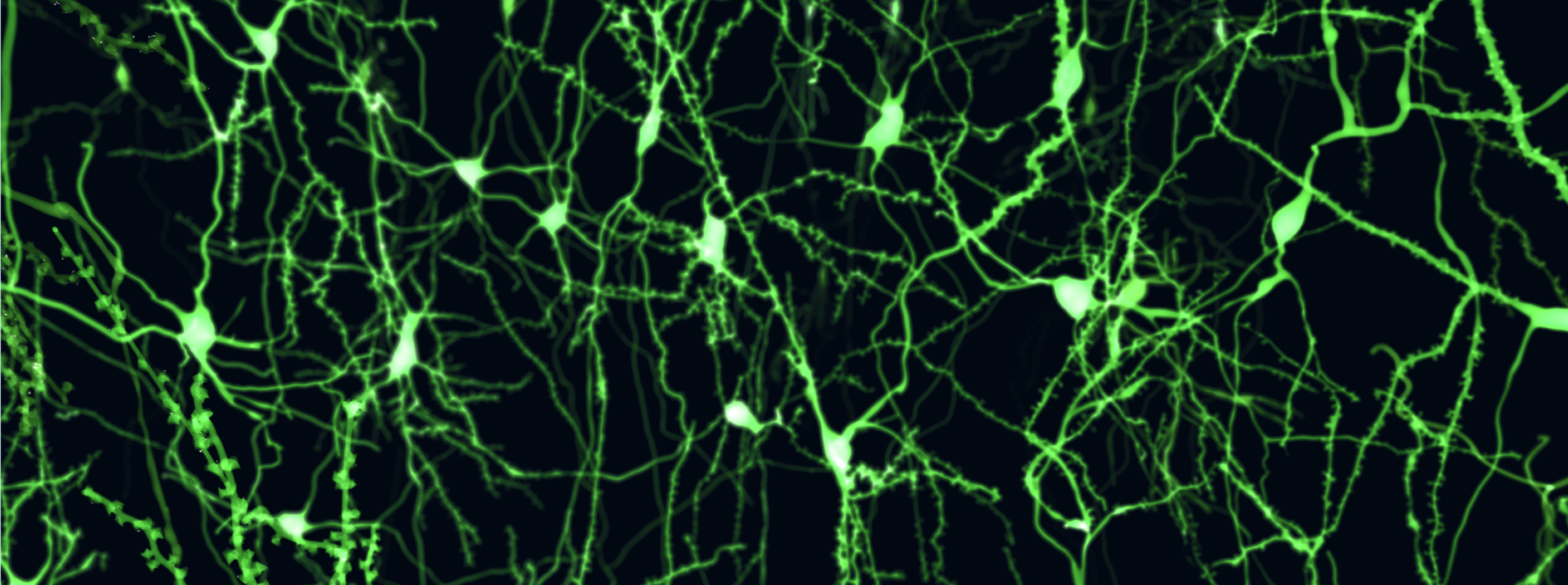 Neuroscience at U of Guelph - link to brochure